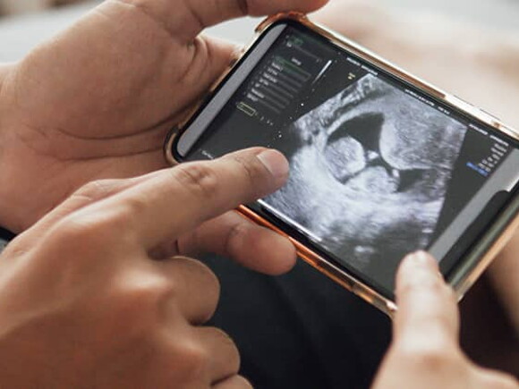 Der 12-Wochen-Ultraschall – das erste Babybild & mehr