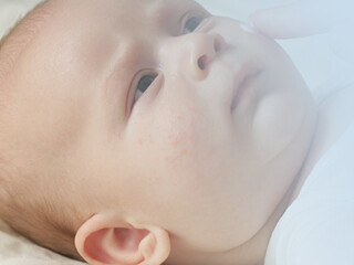 Fragen und Antworten zu Allergien bei kleinen Babys. 