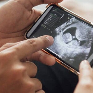 Der 12-Wochen-Ultraschall – das erste Babybild & mehr